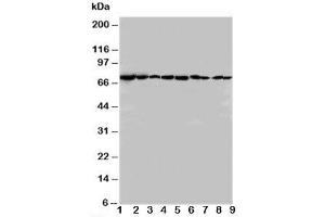 Western blot testing of Hsc70 antibody and Lane 1:  rat testis;  2: rat brain;  3: rat liver;  4: rat lung;  5: CEM;  6: HeLa;  7: SMMC-7721;  8: HT1080;  9: COLO320 cell lysate