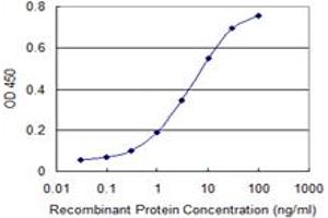 Detection limit for recombinant GST tagged SORT1 is 0.