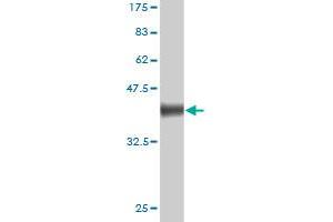 Western Blot detection against Immunogen (38. (Neuropilin 1 anticorps  (AA 22-131))