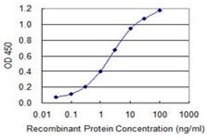 Detection limit for recombinant GST tagged FTCD is 0. (FTCD anticorps  (AA 440-541))
