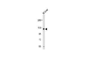 Anti-M Sema5a Antibody (N-term) at 1:1000 dilution + Mouse liver tissue lysate Lysates/proteins at 20 μg per lane.