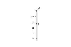 Anti-M Sema5a Antibody (N-term) at 1:1000 dilution + Mouse liver tissue lysate Lysates/proteins at 20 μg per lane. (SEMA5A anticorps  (N-Term))