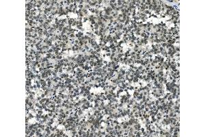 IHC analysis of HOXD11 using anti-HOXD11 antibody (ABIN7603174).