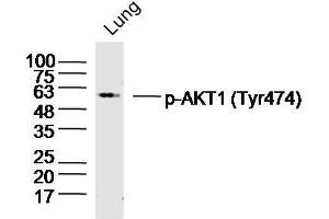 Mouse lung lysates probed with AKT1/2/3 (Tyr474) Polyclonal Antibody, unconjugated  at 1:300 overnight at 4°C followed by a conjugated secondary antibody at 1:10000 for 90 minutes at 37°C. (AKT 1/2/3 anticorps  (pTyr474))