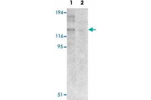 Western blot analysis of NLRP8 in human colon tissue lysate with NLRP8 polyclonal antibody  at 1 ug/mL in (1) the absence and (2) the presence of blocking peptide.