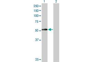 Western Blot analysis of PNPLA3 expression in transfected 293T cell line by PNPLA3 MaxPab polyclonal antibody.