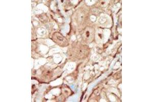 Image no. 2 for anti-Platelet Derived Growth Factor Receptor beta (PDGFRB) (N-Term) antibody (ABIN359919) (PDGFRB anticorps  (N-Term))