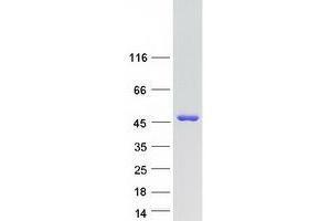 Validation with Western Blot