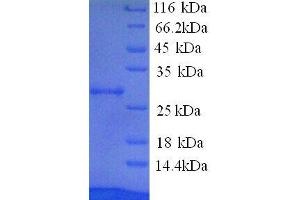 Paraneoplastic Antigen MA2 (PNMA2) (AA 2-364) protein (His tag)
