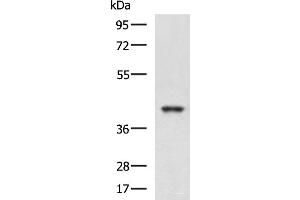 Western blot analysis of K562 and HepG2 cell lysates using RBM4 Polyclonal Antibody at dilution of 1:750 (RBM4 anticorps)