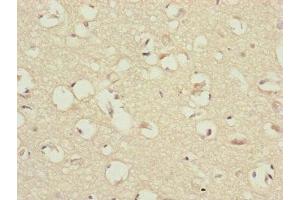 Immunohistochemistry of paraffin-embedded human brain tissue using ABIN7147433 at dilution of 1:100 (CCDC41 anticorps  (AA 34-260))