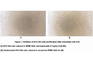 Image no. 2 for Interleukin 24 (IL24) (AA 51-206) (Active) protein (His tag) (ABIN6239770)