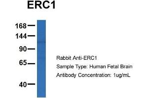 Host: Rabbit  Target Name: ERC1  Sample Tissue: Human Fetal Brain  Antibody Dilution: 1. (ERC1 anticorps  (C-Term))