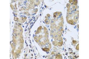 Immunohistochemistry of paraffin-embedded Human stomach using EFHC1 Polyclonal Antibody at dilution of 1:100 (40x lens). (EFHC1 anticorps)