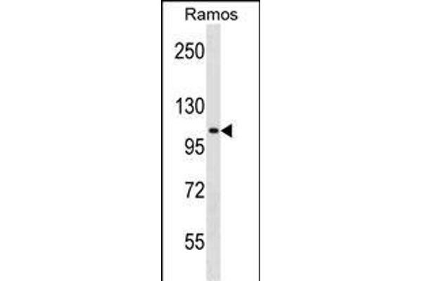 TACC1 anticorps  (N-Term)