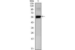 Western blot analysis using PAX6 mAb against human PAX6 (AA: 1-223) recombinant protein.