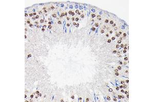 Immunohistochemistry of paraffin-embedded rat testis using PI3 Kinase p85 beta Rabbit mAb (ABIN1679407, ABIN3019246, ABIN3019247 and ABIN7101736) at dilution of 1:100 (40x lens).