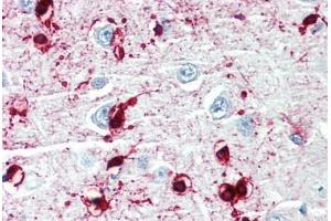 Human Brain, Cortex (formalin-fixed, paraffin-embedded) stained with CRYAB antibody ABIN462098 at 10 µg/ml followed by biotinylated goat anti-rabbit IgG secondary antibody ABIN481713, alkaline phosphatase-streptavidin and chromogen. (CRYAB anticorps)