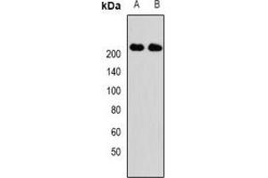 Western blot analysis of KIF1B expression in Hela (A), SKOV3 (B) whole cell lysates. (KIF1B anticorps)