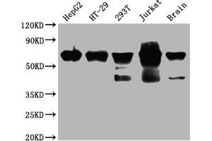 Western Blot Positive WB detected in: HepG2 whole cell lysate, HT-29 whole cell lysate, 293T whole cell lysate, Jurkat whole cell lysate, Mouse brain tissue All lanes: DDX5 antibody at 1:2000 Secondary Goat polyclonal to rabbit IgG at 1/50000 dilution Predicted band size: 70, 61 kDa Observed band size: 70 kDa (Recombinant DDX5 anticorps)