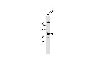 Anti-CCNY Antibody (Center) at 1:1000 dilution + Mouse heart lysate Lysates/proteins at 20 μg per lane. (Cyclin Y anticorps  (AA 140-169))