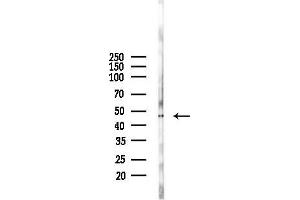 anti-Protein Interacting With Protein Kinase C, alpha 1 (PICK1) (N-Term) antibody