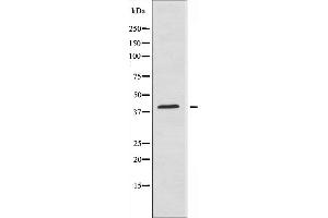 Western blot analysis of extracts from NIH-3T3 cells using ZNF435 antibody. (ZSCAN16 anticorps)