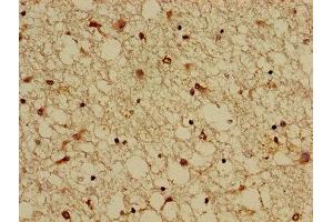 Immunohistochemistry of paraffin-embedded human brain tissue using ABIN7146577 at dilution of 1:100