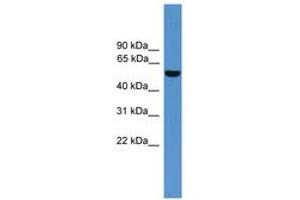 Image no. 1 for anti-Aldehyde Dehydrogenase 9 Family, Member A1 (ALDH9A1) (AA 351-400) antibody (ABIN6746619) (ALDH9A1 anticorps  (AA 351-400))