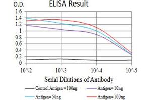 Black line: Control Antigen (100 ng),Purple line: Antigen (10 ng), Blue line: Antigen (50 ng), Red line:Antigen (100 ng)