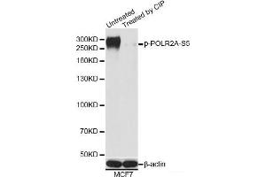 Western blot analysis of extracts of MCF7 cells using Phospho-POLR2A(S5) Polyclonal Antibody at dilution of 1:1000. (POLR2A/RPB1 anticorps  (pSer5))