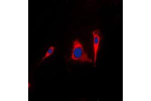 Immunofluorescent analysis of 14-3-3 gamma staining in A431 cells.