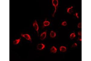 ABIN6266753 staining HeLa by IF/ICC.