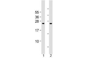 Western blot testing of human 1) cerebellum and 2) spleen tissue lysate with Grancalcin antibody at 1:2000.