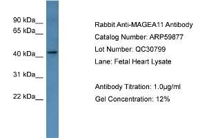 WB Suggested Anti-MAGEA11  Antibody Titration: 0.