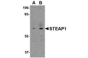 Western Blotting (WB) image for anti-Six Transmembrane Epithelial Antigen of The Prostate 1 (STEAP1) (C-Term) antibody (ABIN2476601)