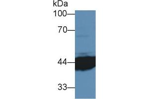 Detection of IL3Ra in Human MCF7 cell lysate using Polyclonal Antibody to Interleukin 3 Receptor Alpha (IL3Ra) (IL3RA anticorps  (AA 167-331))