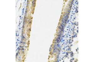 Immunohistochemistry of paraffin-embedded rat lung using ACSS2 Antibody (ABIN6292756) at dilution of 1:100 (40x lens). (ACSS2 anticorps)