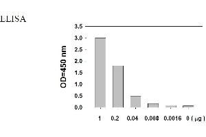Image no. 6 for Epidermal Growth Factor Receptor (EGFR) ELISA Kit (ABIN1981739) (EGFR Kit ELISA)