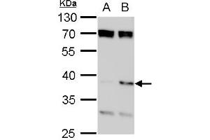 WB Image SET antibody, isoform 2-specifc detects SET protein by western blot analysis. (SET/TAF-I anticorps  (N-Term))
