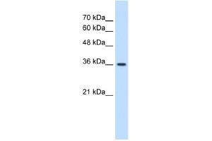 WB Suggested Anti-MAS1 Antibody Titration:  1. (MAS1 anticorps  (Middle Region))