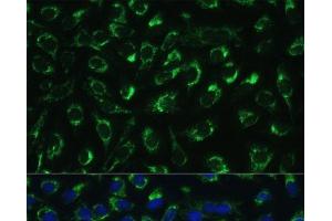 Immunofluorescence analysis of U-2 OS cells using MTIF2 Polyclonal Antibody at dilution of 1:100 (40x lens).