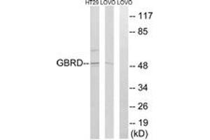 Western blot analysis of extracts from LOVO/HT-29 cells, using GABRD Antibody. (GABRD anticorps  (AA 141-190))