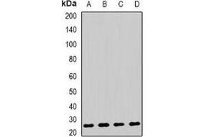 Western blot analysis of AK4 expression in HepG2 (A), Raji (B), mouse liver (C), mouse kidney (D) whole cell lysates. (AK4 anticorps)