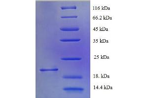 SDS-PAGE (SDS) image for Muscarinic Acetylcholine Receptor M1 (CHRM1) (AA 210-366), (Cytoplasmic Domain), (Cytosolic) protein (His tag) (ABIN5709283)