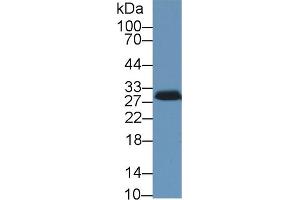 Detection of STAR in Porcine Adrenal gland lysate using Polyclonal Antibody to Steroidogenic Acute Regulatory Protein (STAR)