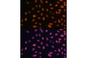 Immunofluorescence analysis of U-2 OS cells using HMG Rabbit mAb (ABIN7267646) at dilution of 1:100 (40x lens).