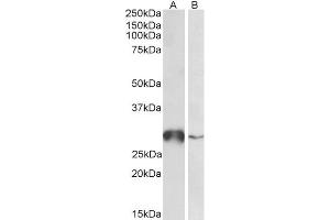 ABIN5539847 (0. (GSTO1 anticorps  (Internal Region))