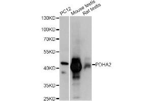 Western blot analysis of extracts of various cell lines, using PDHA2 antibody (ABIN6293729) at 1:1000 dilution. (PDHA2 anticorps)