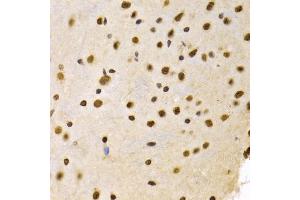 Immunohistochemistry of paraffin-embedded mouse brain using DNMT3A Antibody (ABIN1872325) at dilution of 1:100 (40x lens). (DNMT3A anticorps)